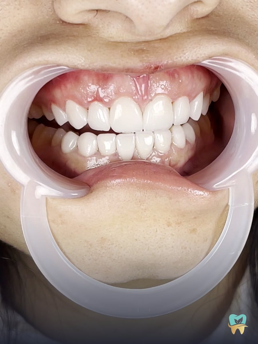 ابتسامة هوليود في المقطم - Smile Oasis